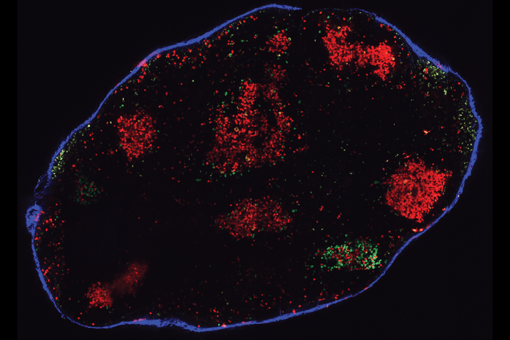 lymph node germinal centers