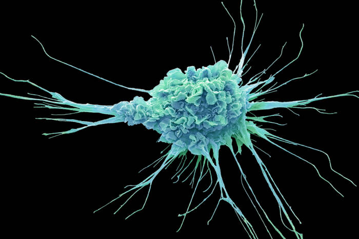 Teal-colored scanning electron micrograph image of a dendritic cell
