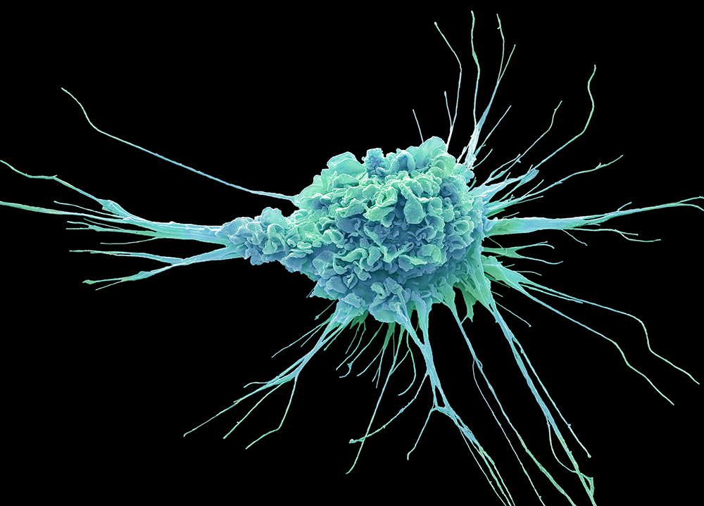 Teal-colored scanning electron micrograph image of a dendritic cell