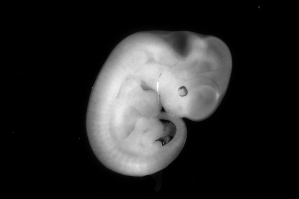 birsoy embryo