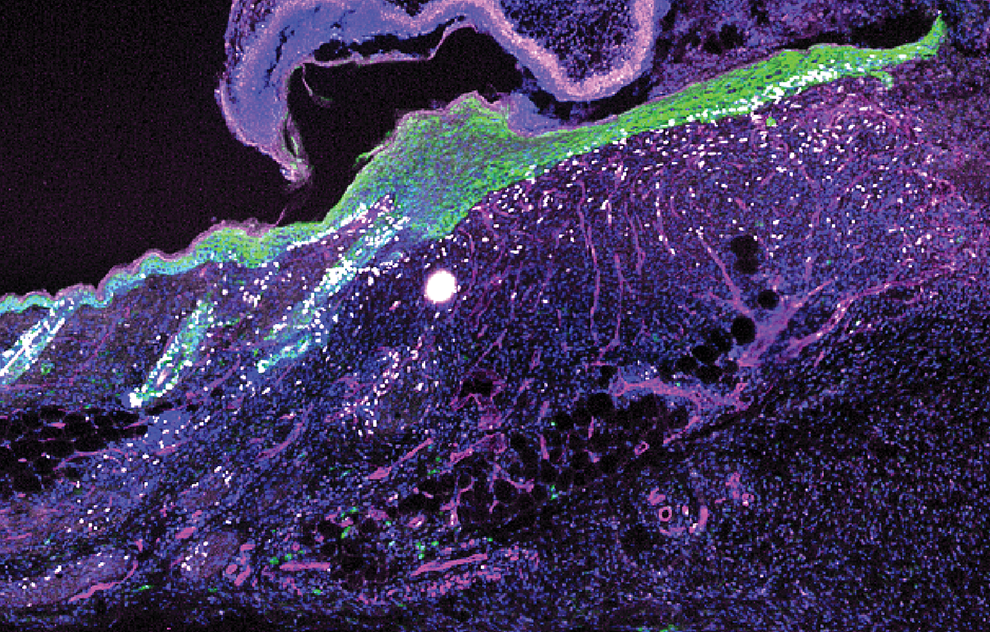 Skin cells proliferating to heal a skin wound