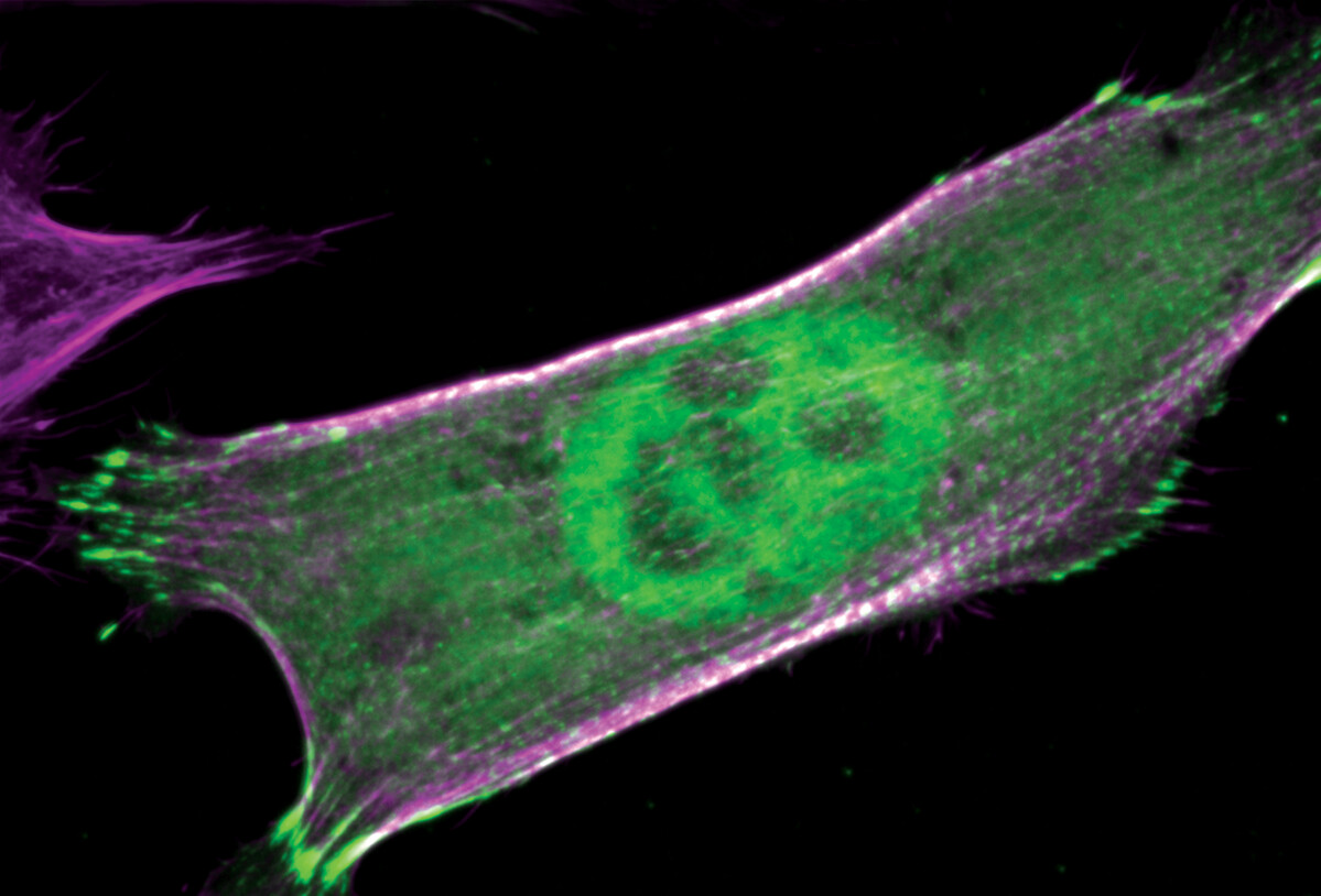 Purple and green actin fibers and nucleus in a cell