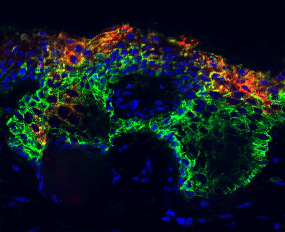 Genetic expression of SOX9 transcription factor in green, blue, and red