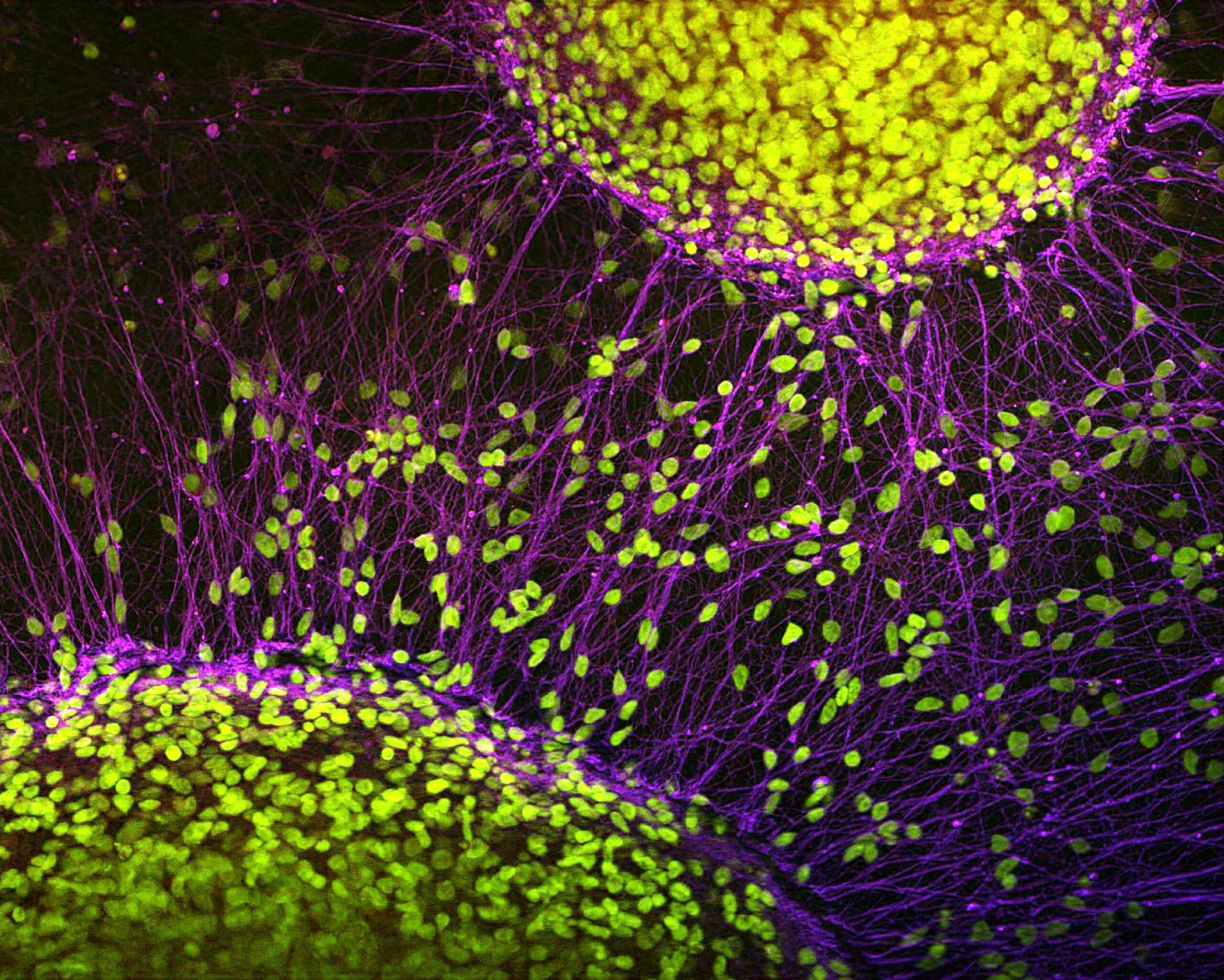 Stem cell-derived neurons, light micrograph