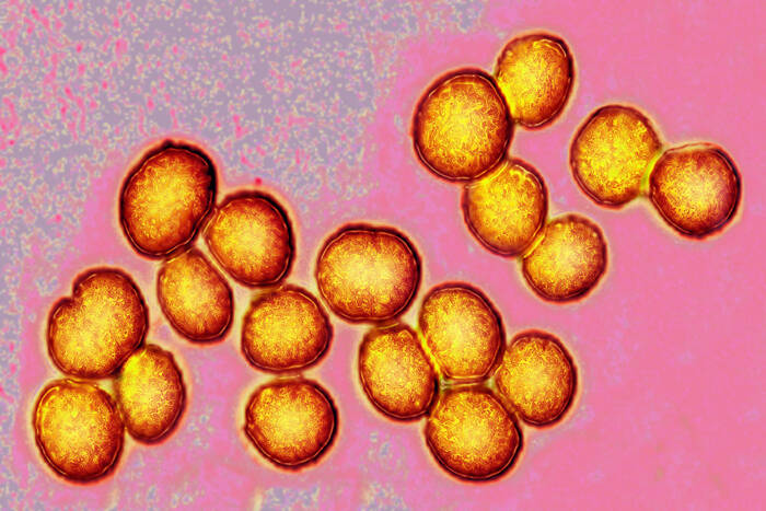 Light micrograph of Staphylococcus aureus