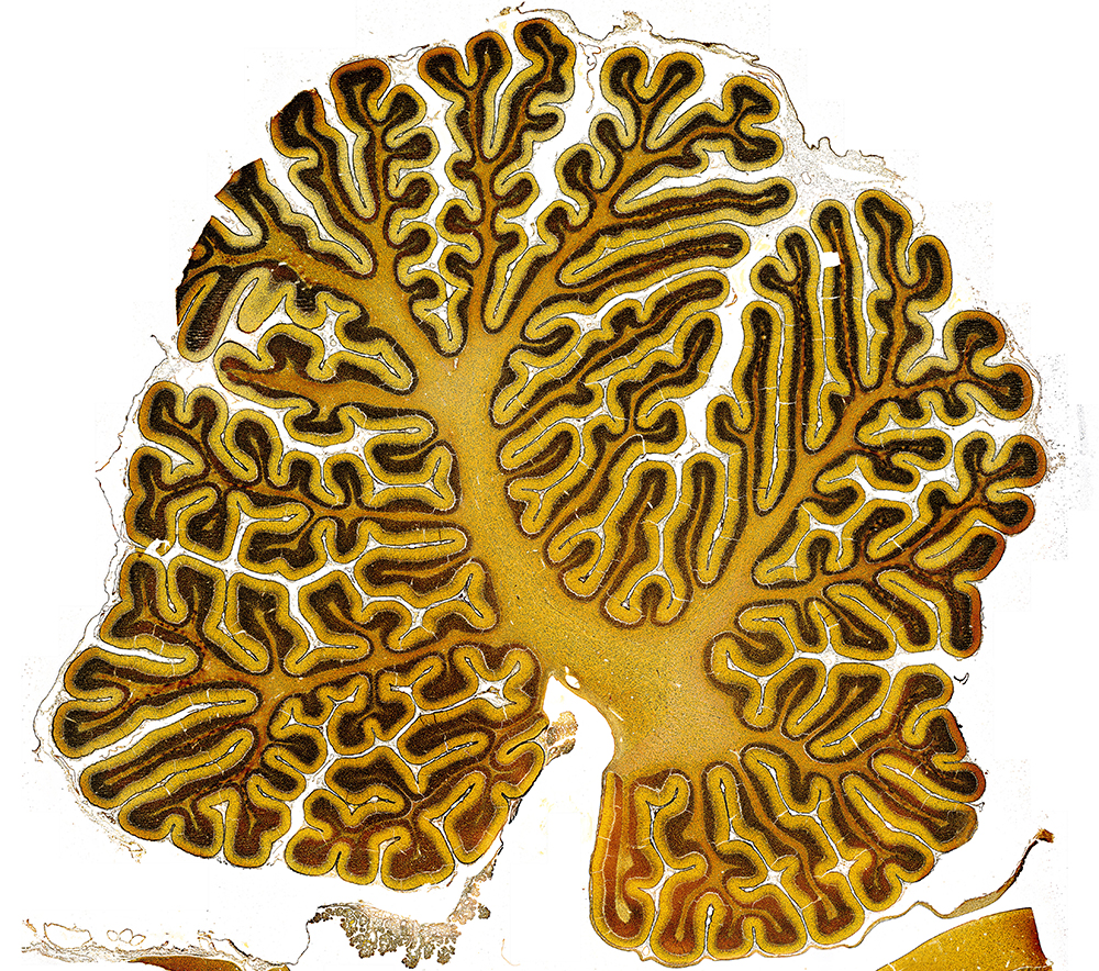 A light micrograph of the cerebellum and its many folds in brown and yellow