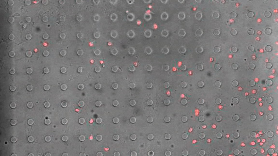 Macrophages in pink against a gray grid