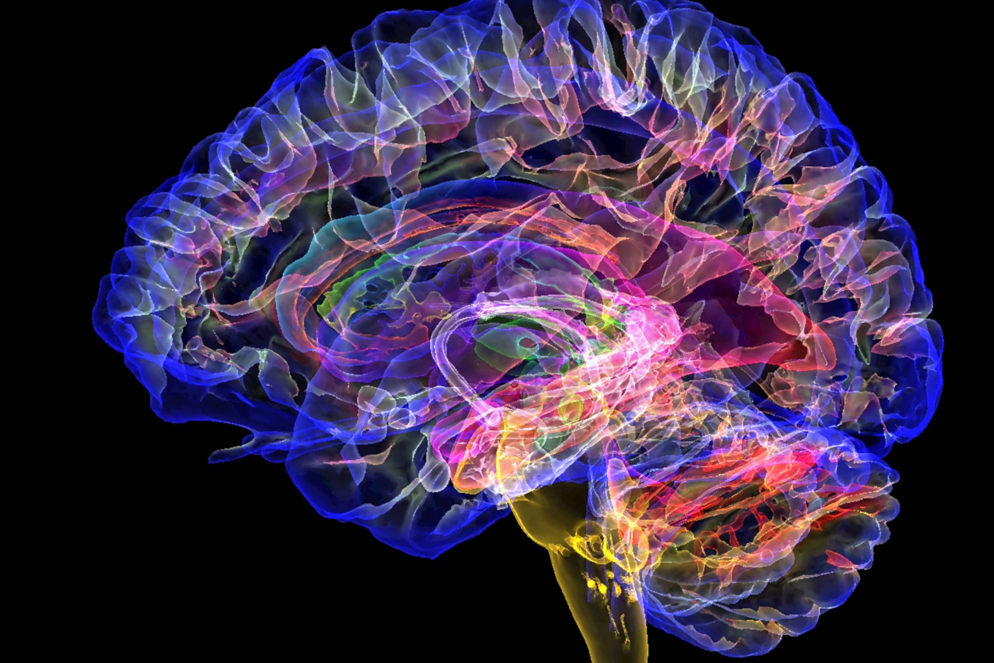 Colored 3D MRI scan of a sagittal section through a healthy human brain