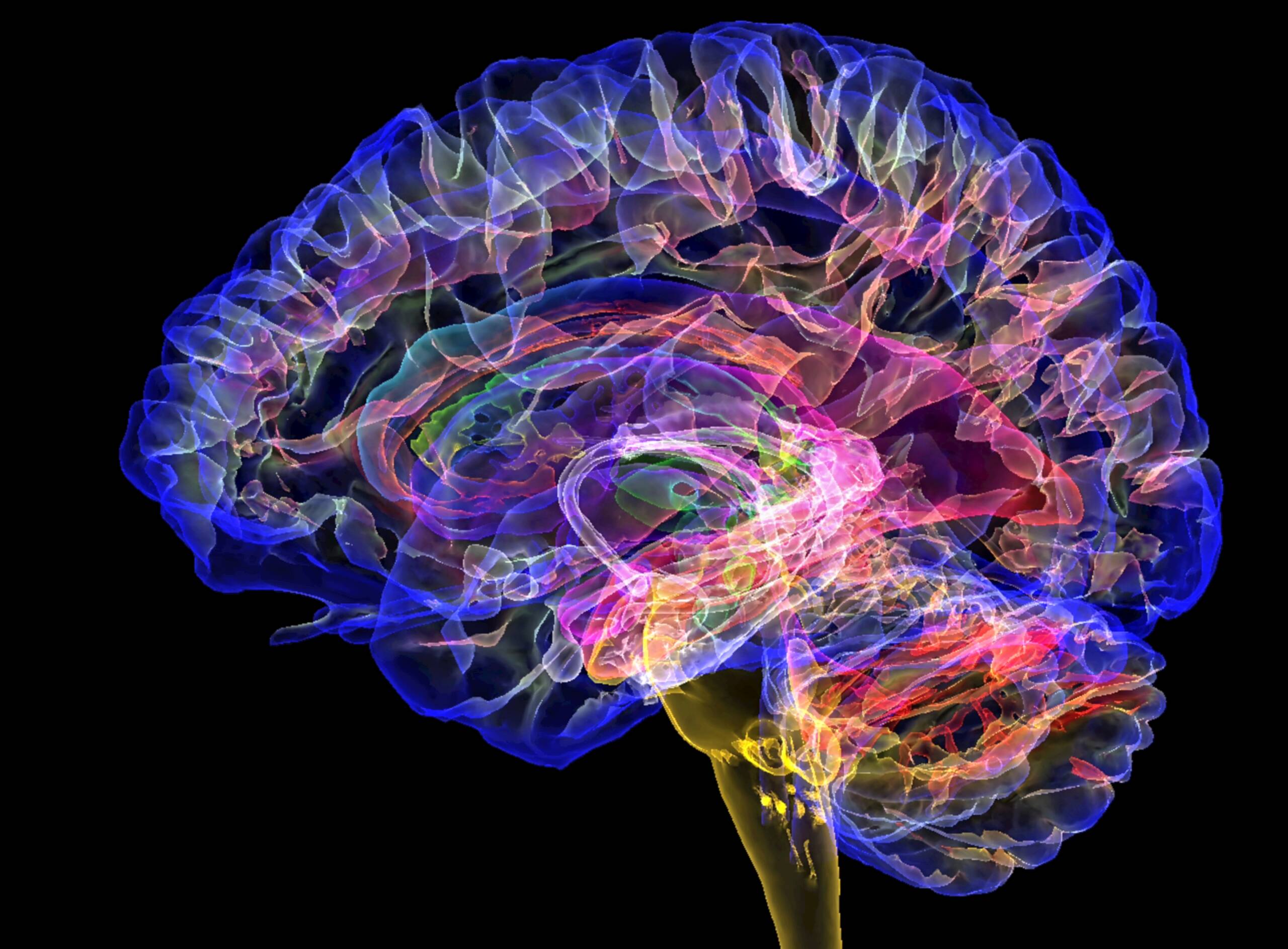 Colored 3D MRI scan of a sagittal section through a healthy human brain