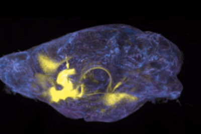 The second image is a cleared whole mouse brain with projection mapping originated from the nucleus accumbens - a brain-wide mapping approach used in our paper.