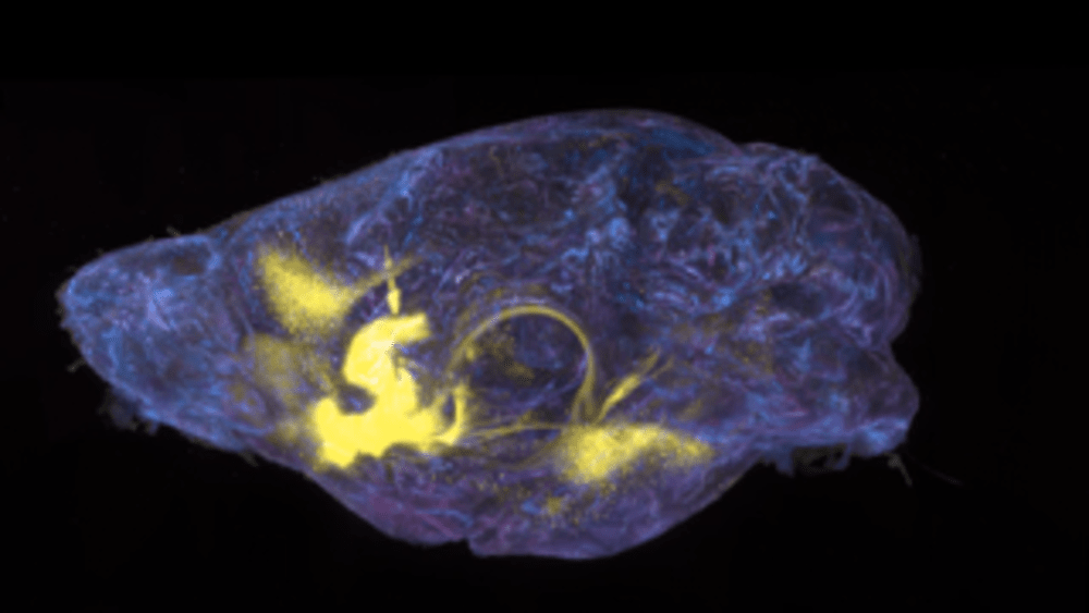  The second image is a cleared whole mouse brain with projection mapping originated from the nucleus accumbens - a brain-wide mapping approach used in our paper.