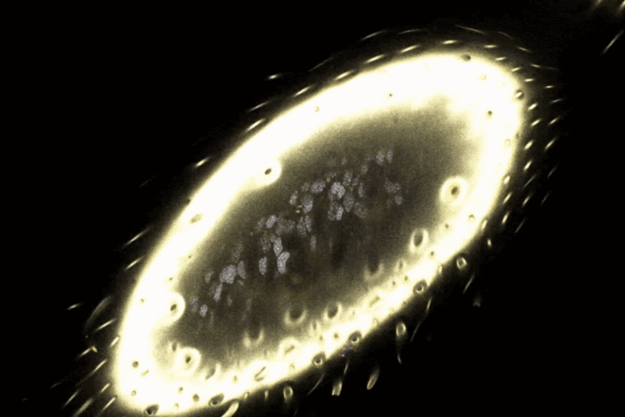 ant's antenna stained