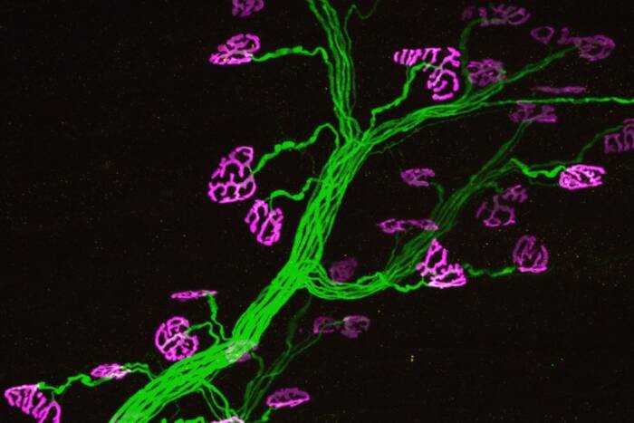 motor neuron steller