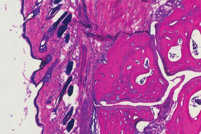 A histology showing the ankle joint of a mouse 4 days after receiving the new antibody treatment, V11 sFc