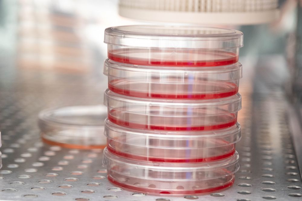 Cell culture plates in the Roeder lab where scientists recently studied gene expression in breast cancer. (Credit: Lori Chertoff)