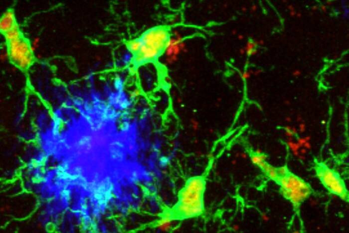 Microglia (green) responding to aggregated beta-amyloid plaques (blue) in the mouse cortex. (Credit: Jessica M. Crowley)