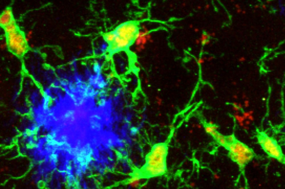 Microglia (green) responding to aggregated beta-amyloid plaques (blue) in the mouse cortex. (Credit: Jessica M. Crowley)