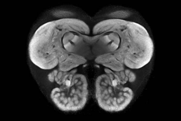Researchers created this first-of-its kind map by merging 40 ant brains into one.