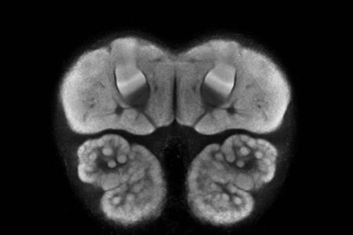 Researchers created this first-of-its kind map by merging 40 ant brains into one.