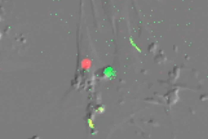 Single cell imaging of senescent cells (which usually do not divide) undergoing multiple divisions after ATM inhibition—their red nucleus turns green before division. (Credit: de Lange lab)