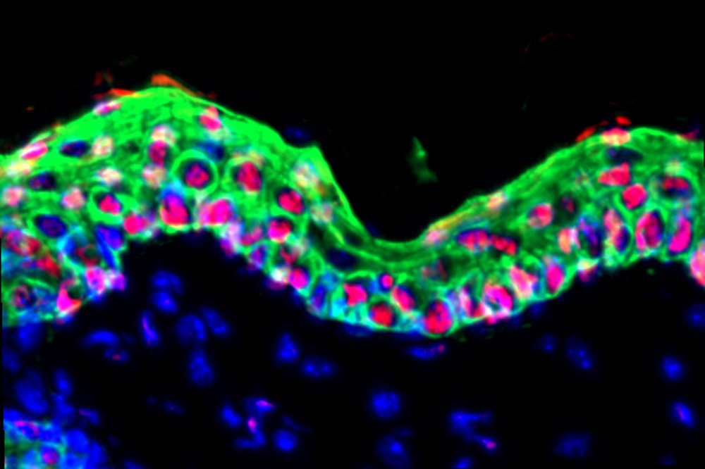 Upon inflammation, mouse epidermal stem cells (green) proliferate and upregulate H2A.Z (red), a histone variant essential for the long-term propagation of inflammatory memory. (Credit: Fuchs lab) 