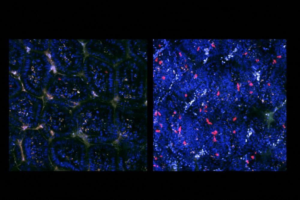 Live imaging (intravital imaging) within the intestine of TRACK mice. Left: Healthy, Right: Infected. Blue: Epithelial cells, Red: Labeled T cells responding to an enteric viral infection. (Credit: Mucida lab) 