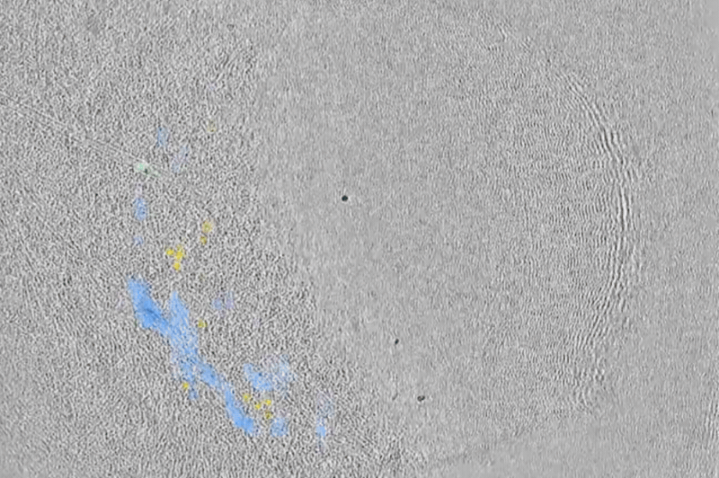 The team used cryo-electron tomography to visualize how forces generated by myosin impact the structure of actin filaments inside cells.