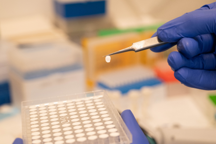 Shanshan Liu and Mark Gad developed a liposome-based transport assay to characterize SLC33A1 transport activity. (Credit: Lori Chertoff)