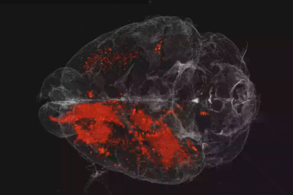 The scientists used 3D modeling to visualize West Nile Virus infection events in the mouse brain. (Credit: Rice lab)