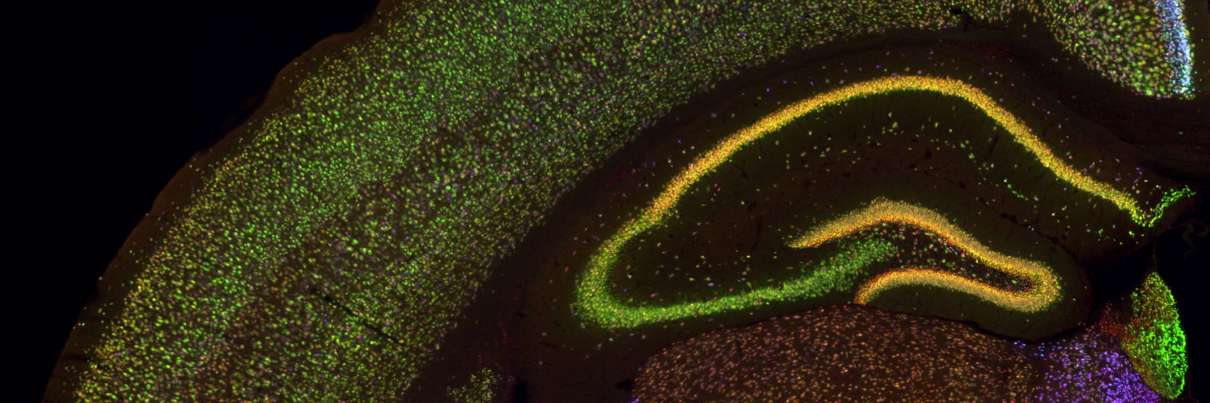 Image of mouse brain