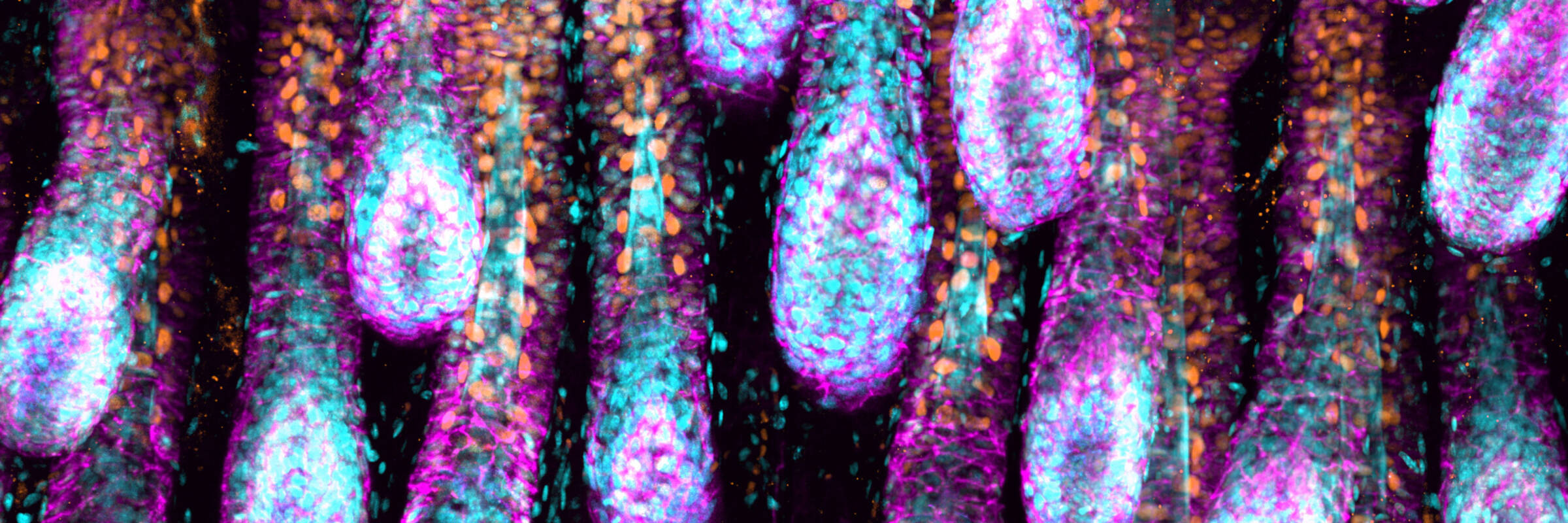 Murine hair follicles during the anagen hair cycle