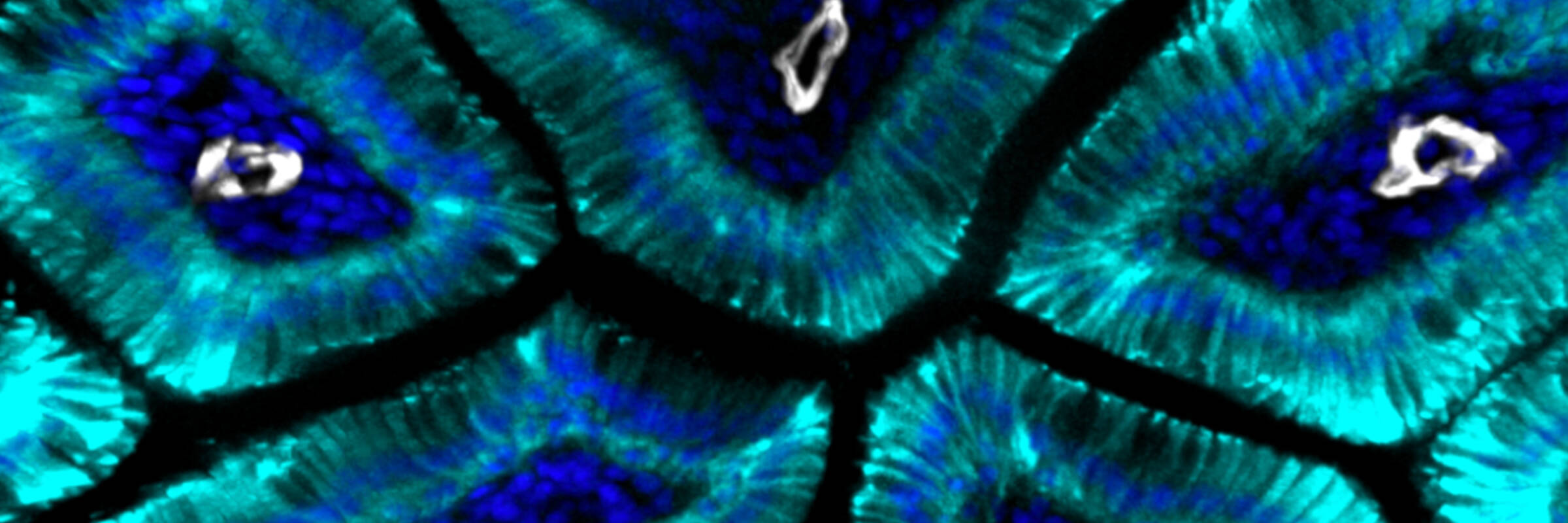 Mouse small intestine lymphatic vasculature (white) and differentiated epithelial cells (aqua)