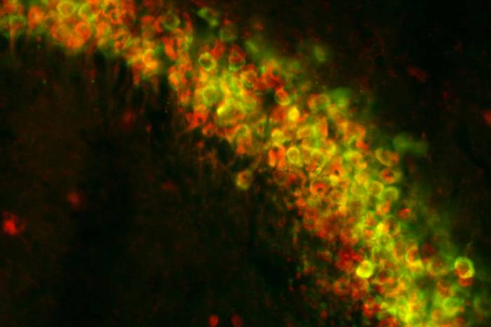CA3 neurons in the mouse hippocampus. Red is neural marker; green is GFP-TRAP