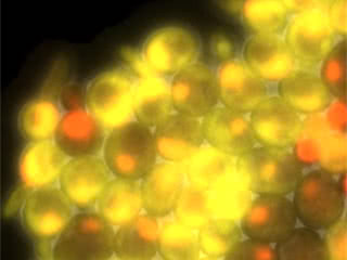 Image of yeast cells