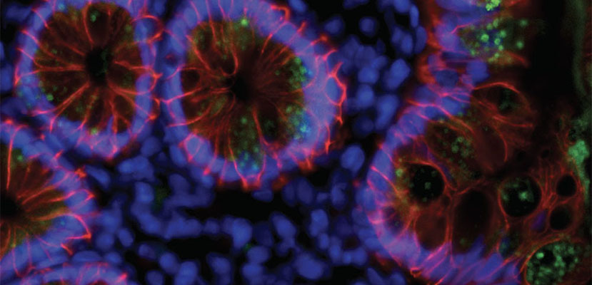 SARS-CoV-2 in human intestine