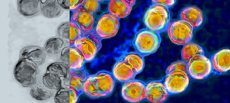 C0605202 Streptococci FPO2