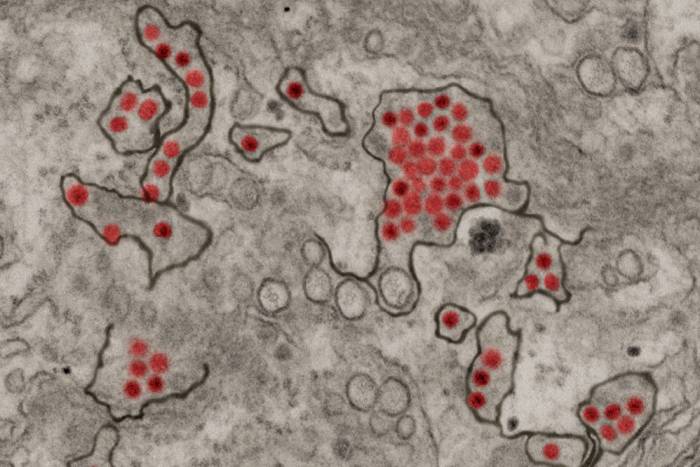 blastoid brivanlou blastocyst