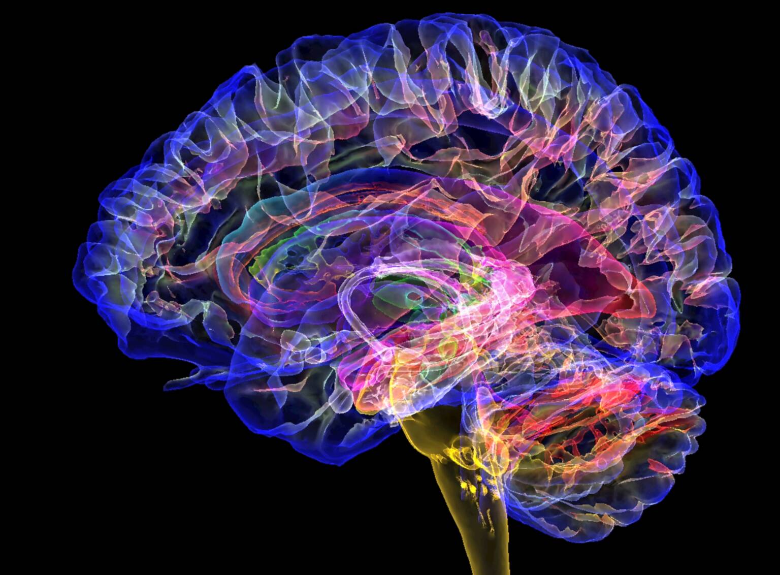 Human brain 3D MRI scan