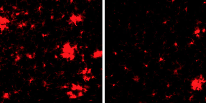 inflammation2-home