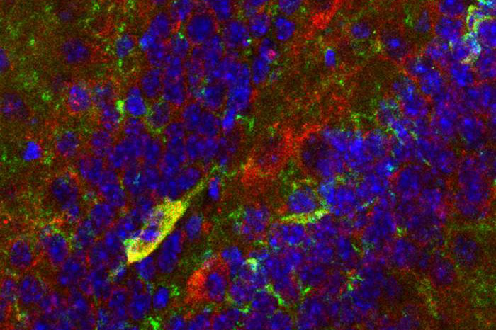 CCK Neurons