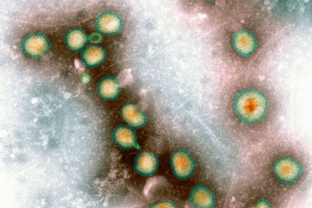 Avian influenza