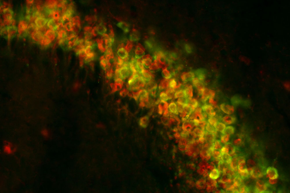 CA3 neurons