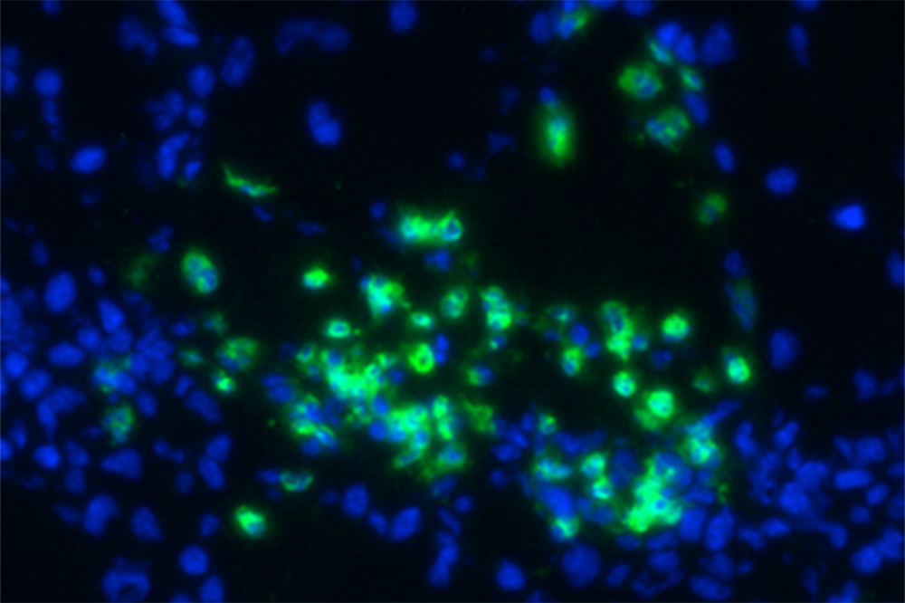 myeloid-derived suppressor cells