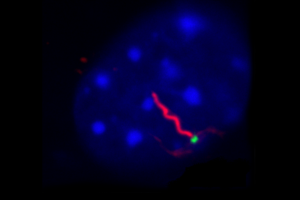 DAPI, Gamma-tubulin, Acetylated-tubulin