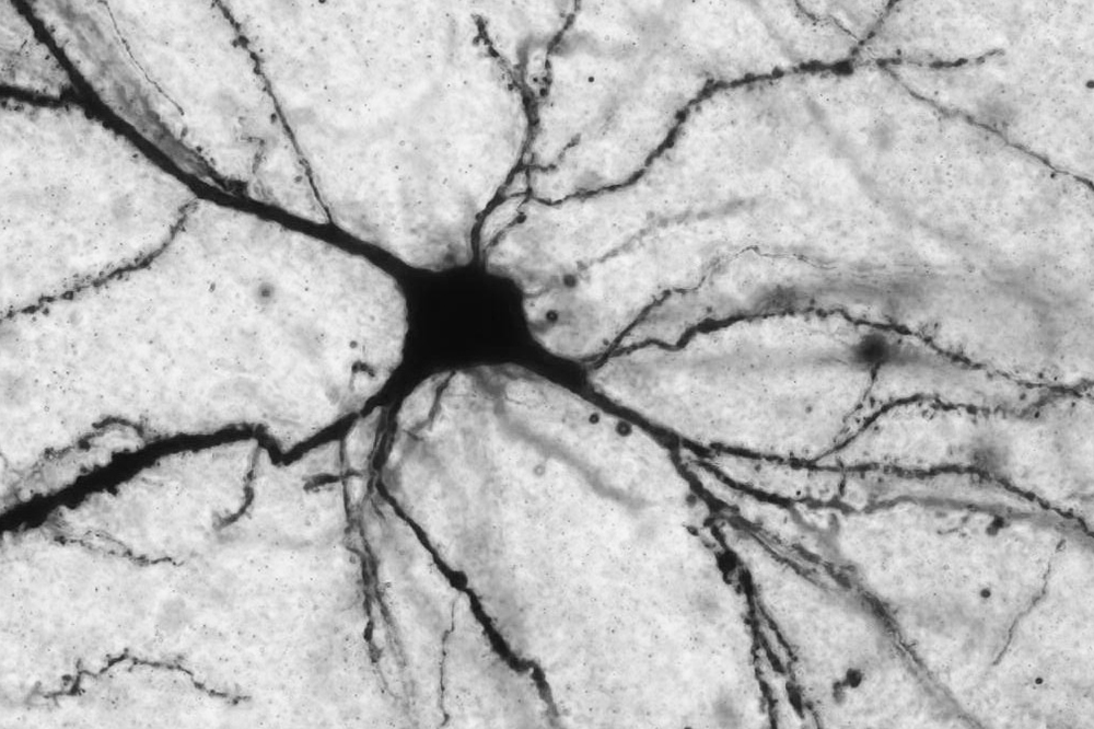 Acetyl-L-carnitine acts on neurons (pictured here) that release the neurotransmitter glutamate. Researchers believe that, by altering glutamate levels, the molecule affects systems involved in depression.