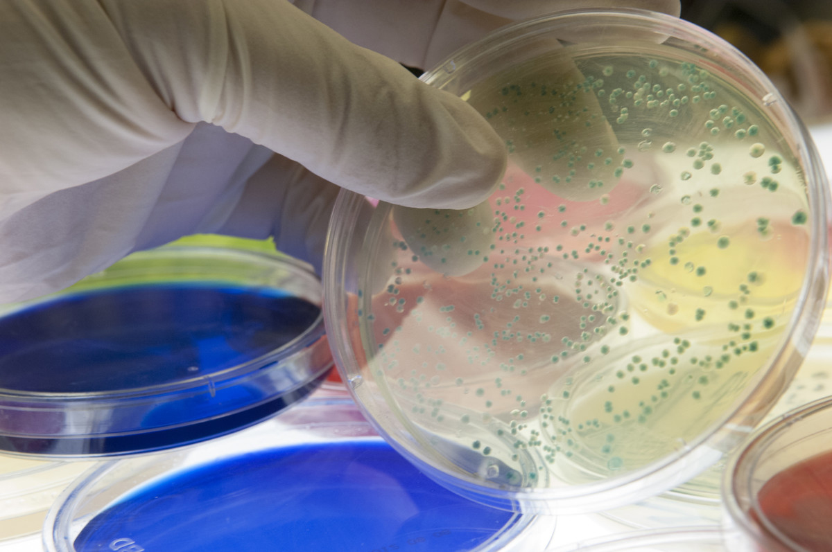 Though small and seemingly simple organisms, bacteria are equipped with effective, multifaceted immune systems.