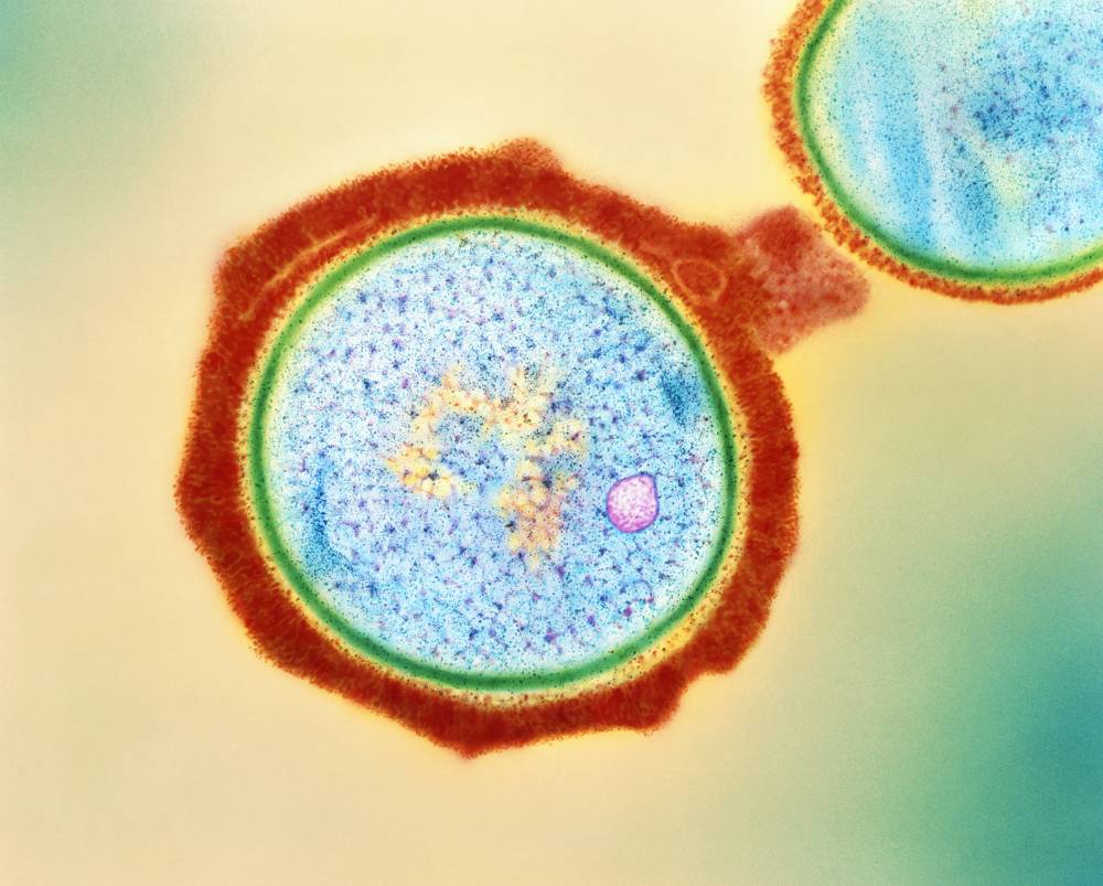 Infections caused by methicillin-resistant Staphylococcus aureus (pictured), can lead to serious health complications. Lysins help fight such infections by destroying the bacterium’s cell wall (green), thereby killing the microbe.