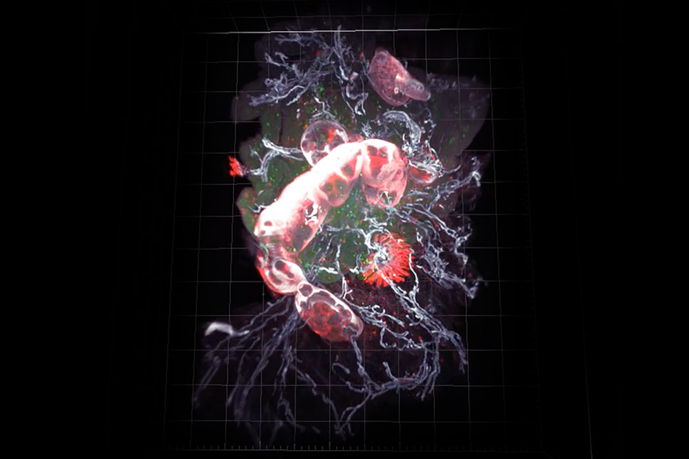 Immune system of intestine