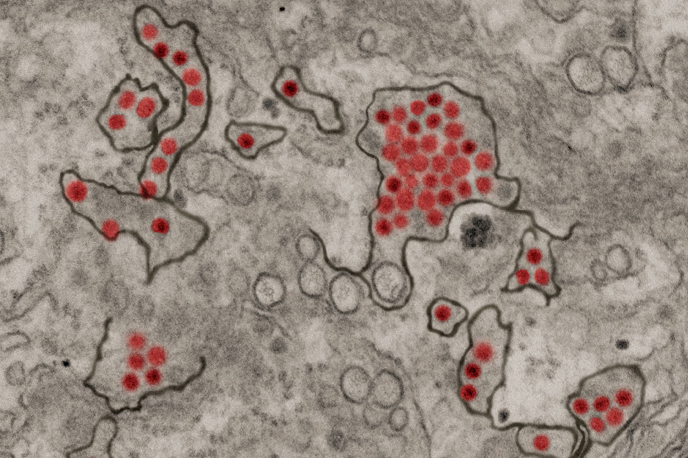 Kidney cells