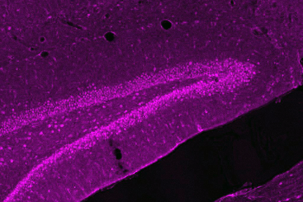 Hippocampus microscopy